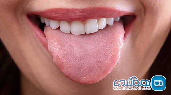 چرا باید زبان خود را تمیز کنیم؟