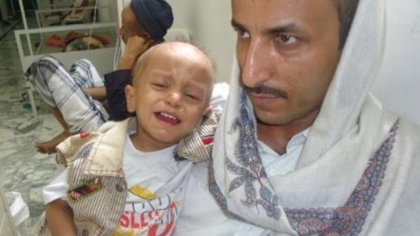 3 هزار کودک سرطانی یمن، در معرض خطر مرگ قرار دارند
