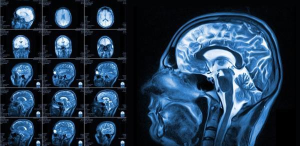 ثبت واضح ترین اسکن های مغزی به وسیله محققان
