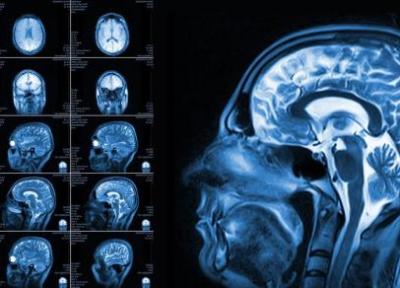 ثبت واضح ترین اسکن های مغزی به وسیله محققان