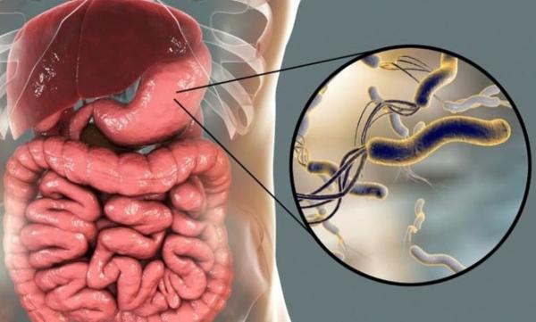 درمان هلیکوباکتر پیلوری چگونه است؟ علاﺋم و راه های تشخیص